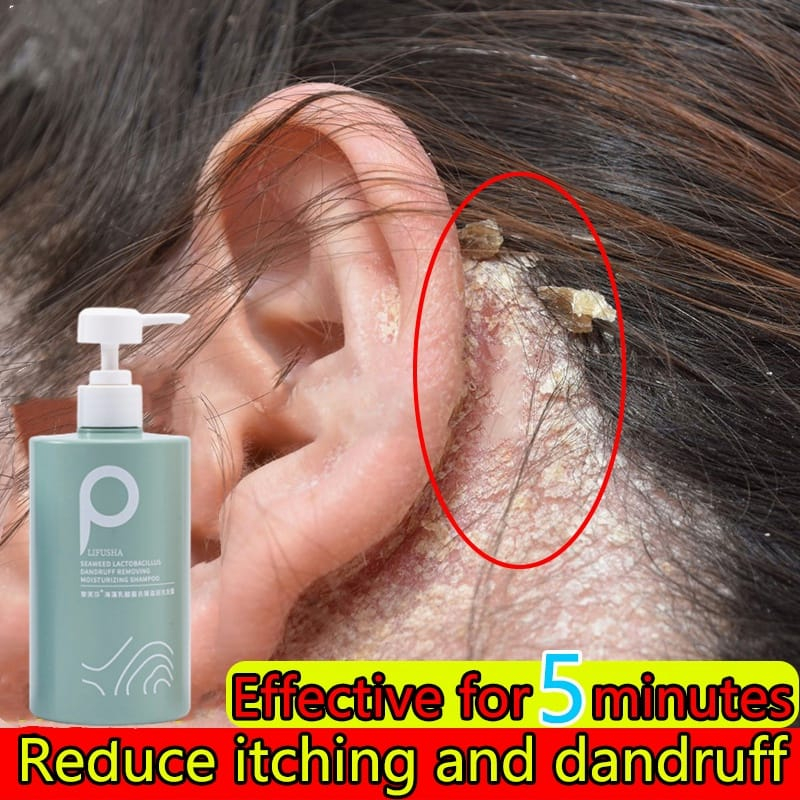 LFS Goat Milk Amino Acid Anti Dandruff Sea Salt Shampoo For Psoriasis