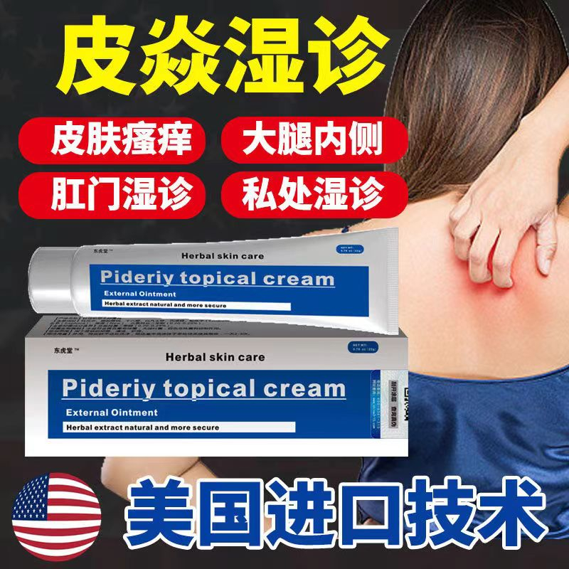 Dermatitis eczema skin itching thighs inner hand, foot, body and