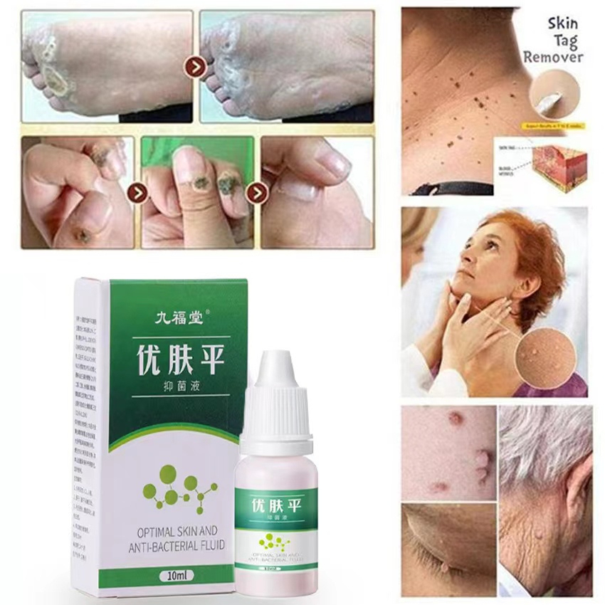 3 Boxes Removal Serum Warts And Skin Tags Remover Warts Remover Original Cream Original Warts 5181