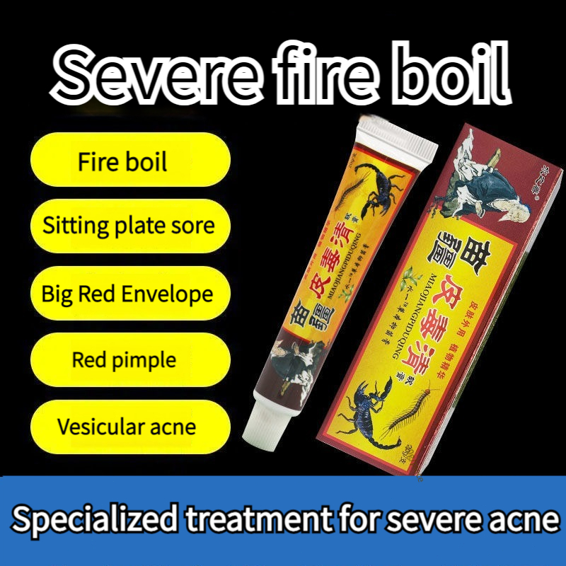 【SG Stock】Hard lump abscess redness inflammation skin itching swelling