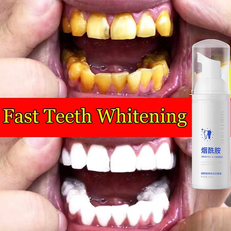 Teeth Whitening Teeth Mousse Whitening Toothpaste Remove Stains Yellow