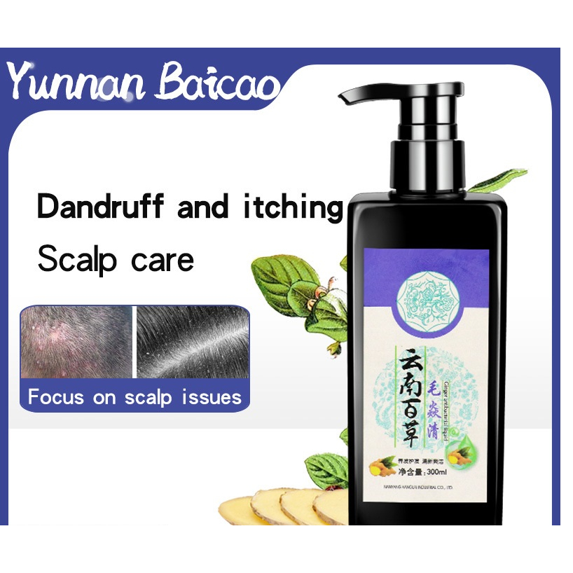 Ginger Antibacterial Shampoo Scalp Folliculitis Shampoo Oil Control