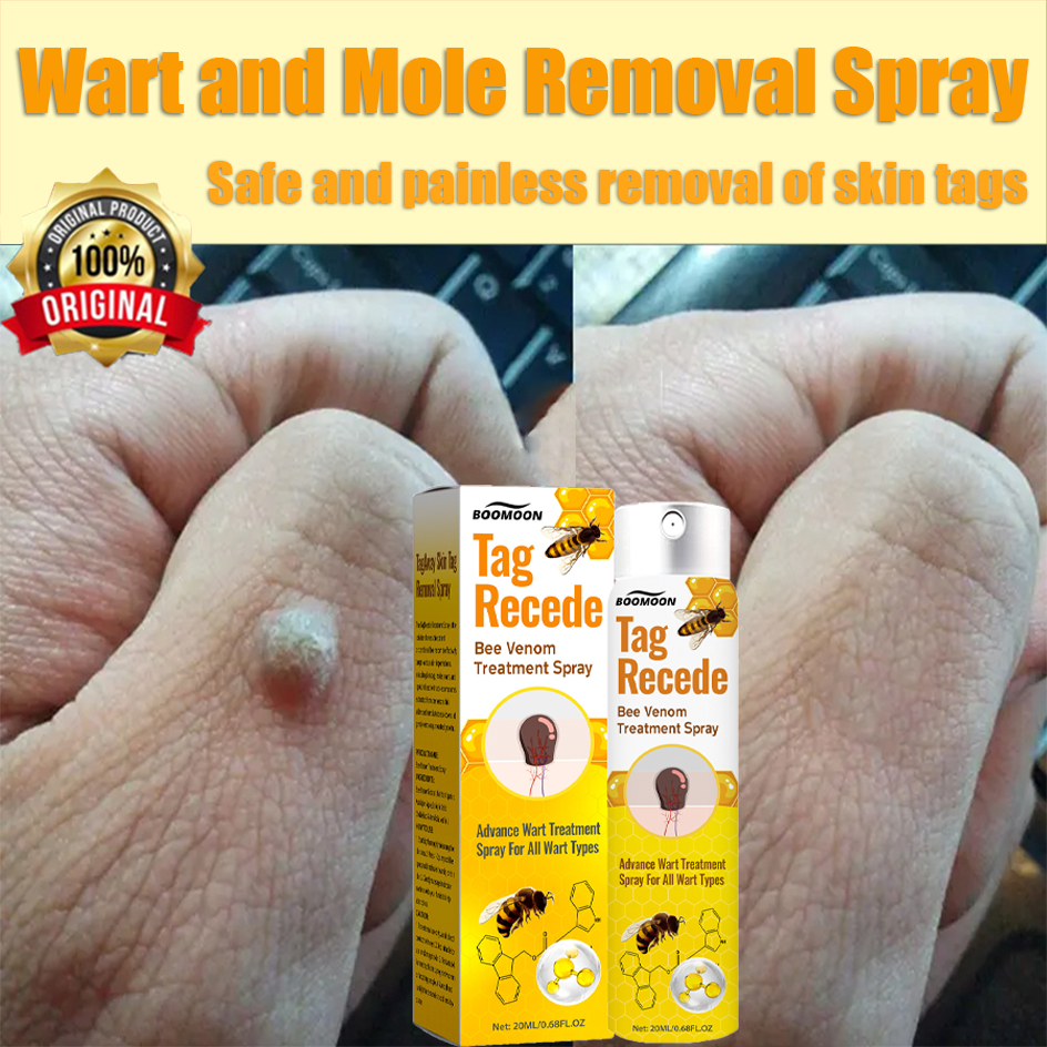 wart removal bee venom spray wart remover skin tag remover tag recede ...