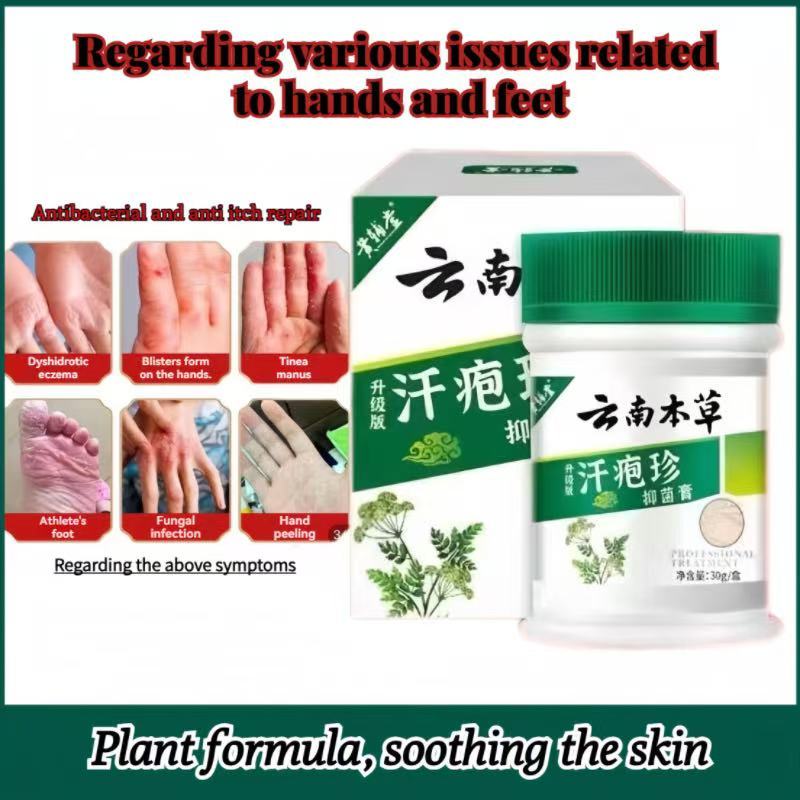 【𝑺𝑮 𝑺𝑻𝑶𝑪𝑲】Sweat Bubble Herpes Cream for Hand Blisters Sweat Herpes Anti ...