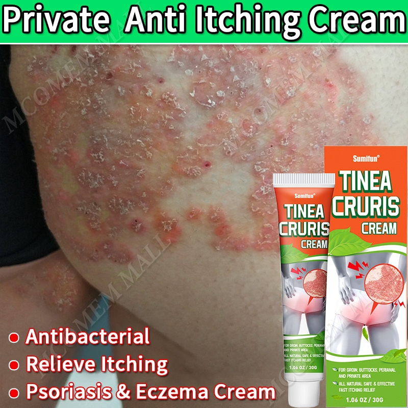 Eczema Cream Private Parts Antibacterial Relieve Itching Psoriasis ...