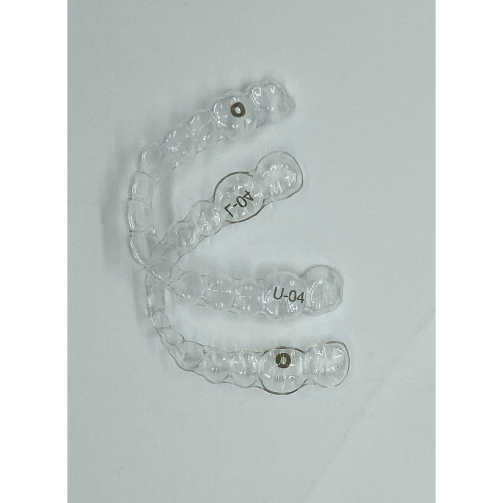 Customized Clear aligner treatment Package (Moderate Case) | Shopee ...