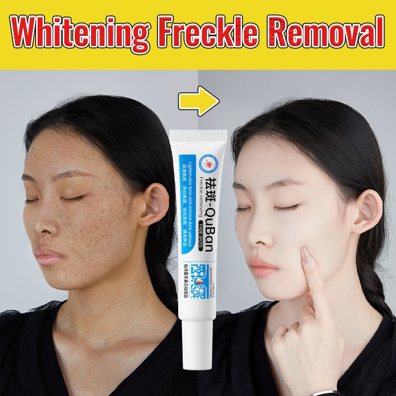 Korea No.1 Whitening Freckle Cream Brighten Skin Blackhead