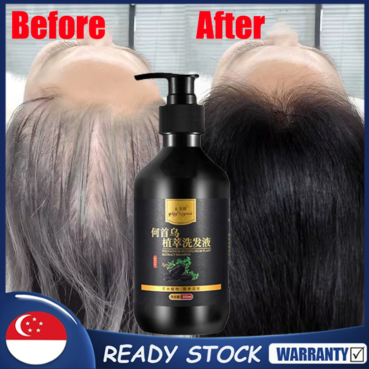 SG [READY STOCK]300ml White Hair To Black Hair Shampoo Polygonum Herbal Shampoo Hair Growth