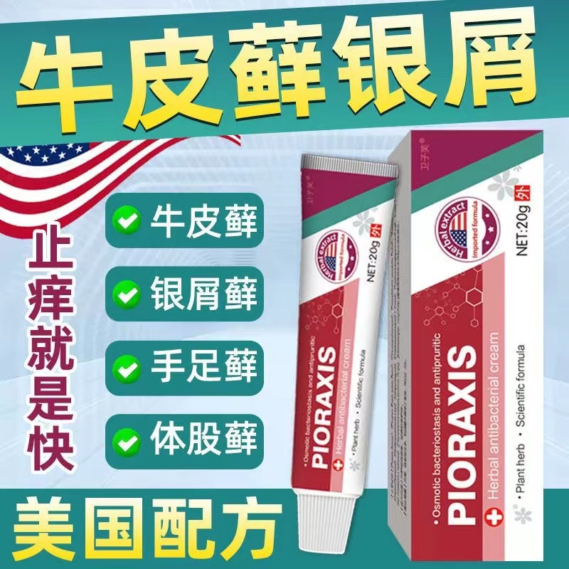 Imported formula psoriasis, psoriasis, eczema, itchy skin, topical