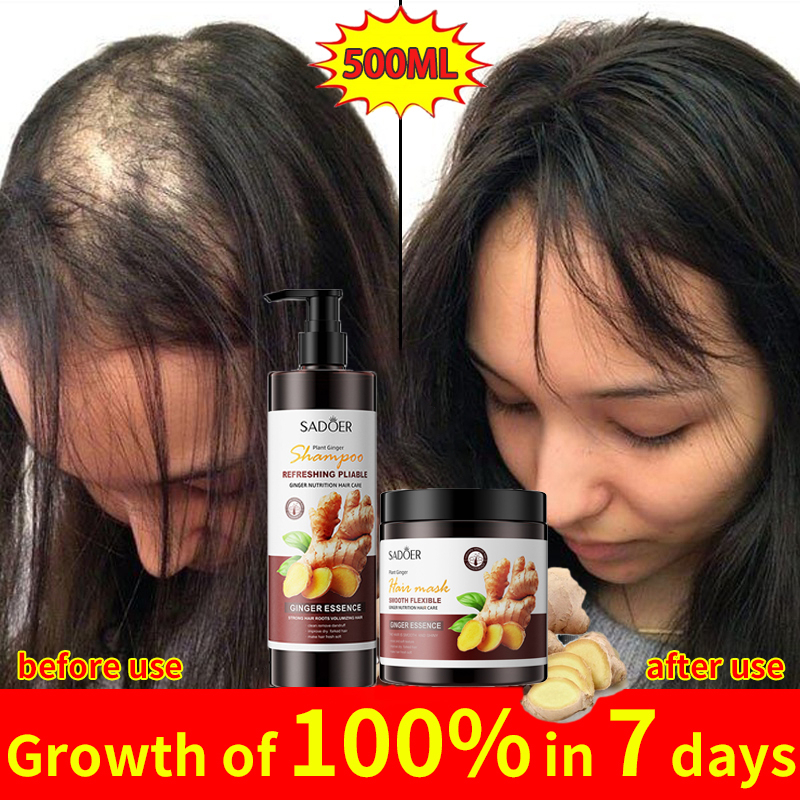 Fast Hair Growth Hair Ginger Shampoo Follicle Treatment Hair Growth Seborrheic Alopecia Hairline