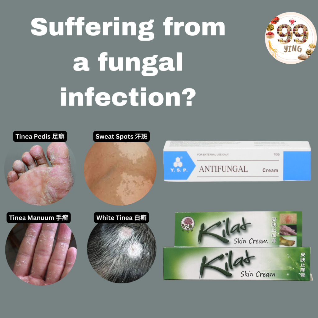 Anti Fungal Creams 抗真菌霜（Kilat Skin Cream, YSP Anti Fungal Cream, Itch ...