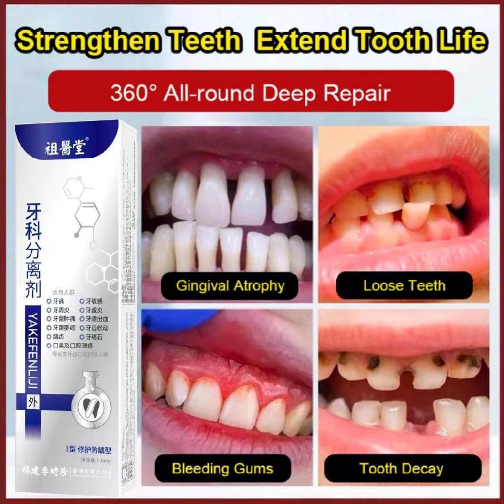 Zuyitang Li Shizhen Dental Separation Agent Teeth Strengthening ...