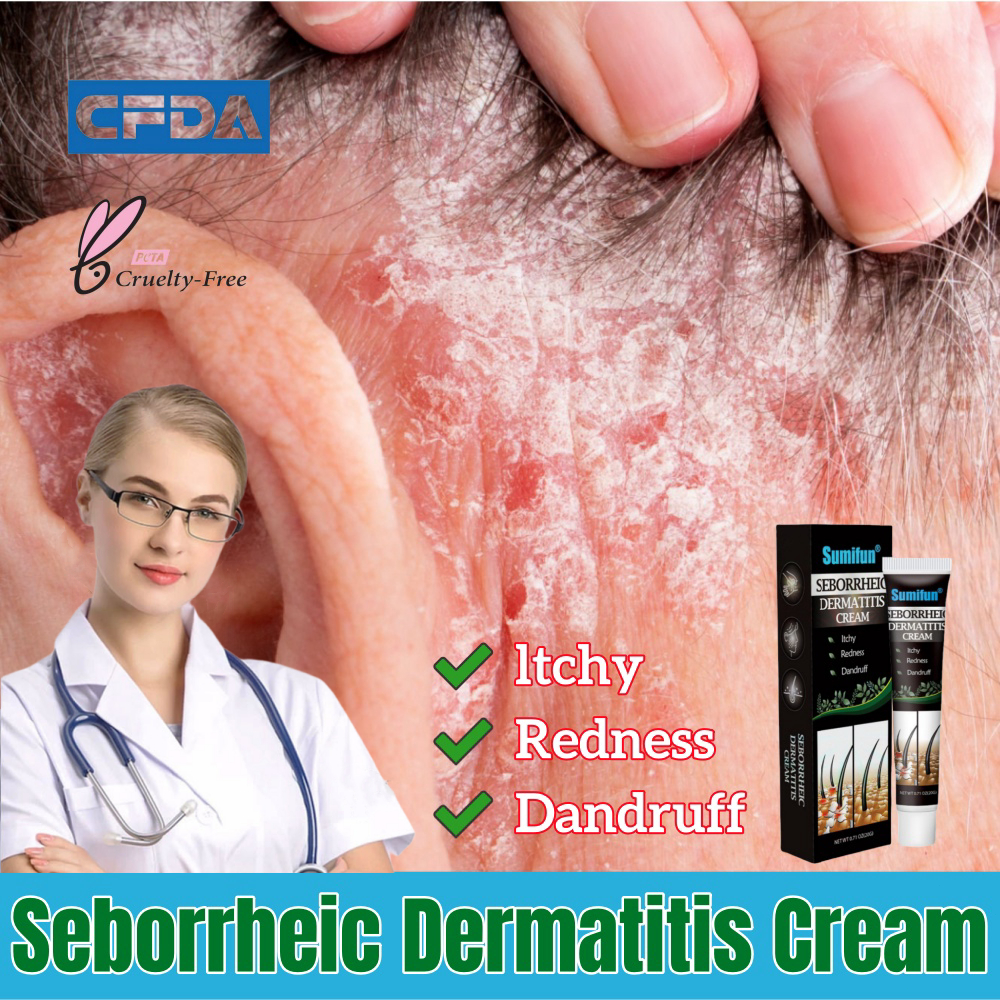 Seborrheic Dermatitis Cream Hair Root Dermatitis Ointment Folliculitis Balm Relief Itchy Redness