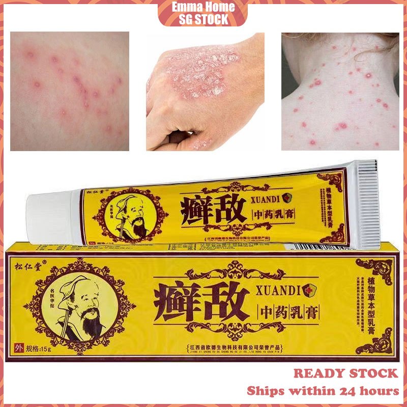 🚀SG Stock🚀XUANDI 癣敌 Chinese Traditional Herbal Cream Eczema cream ...