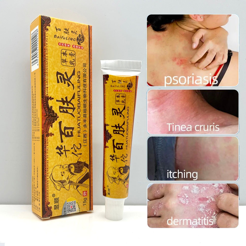 SG STOCKS! Natural Chinese Herbal Medicine Anti Itch Cream For Skin