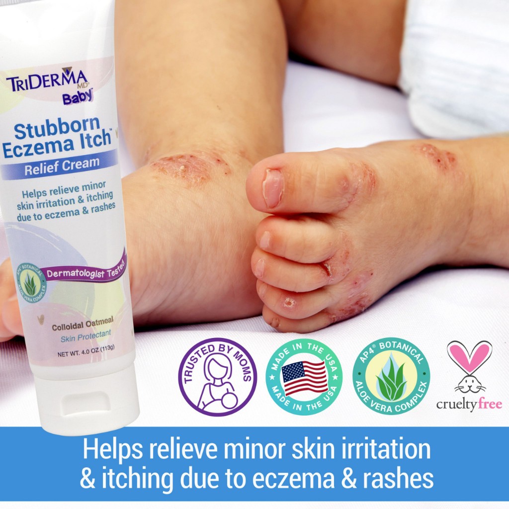 TriDerma Stubborn Eczema Itch Relief Cream, 113g | Shopee Singapore