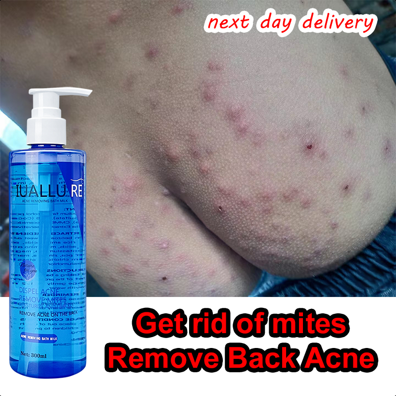 acne body wash shower gel antimite body wash 300ml Body cleaner/Remove