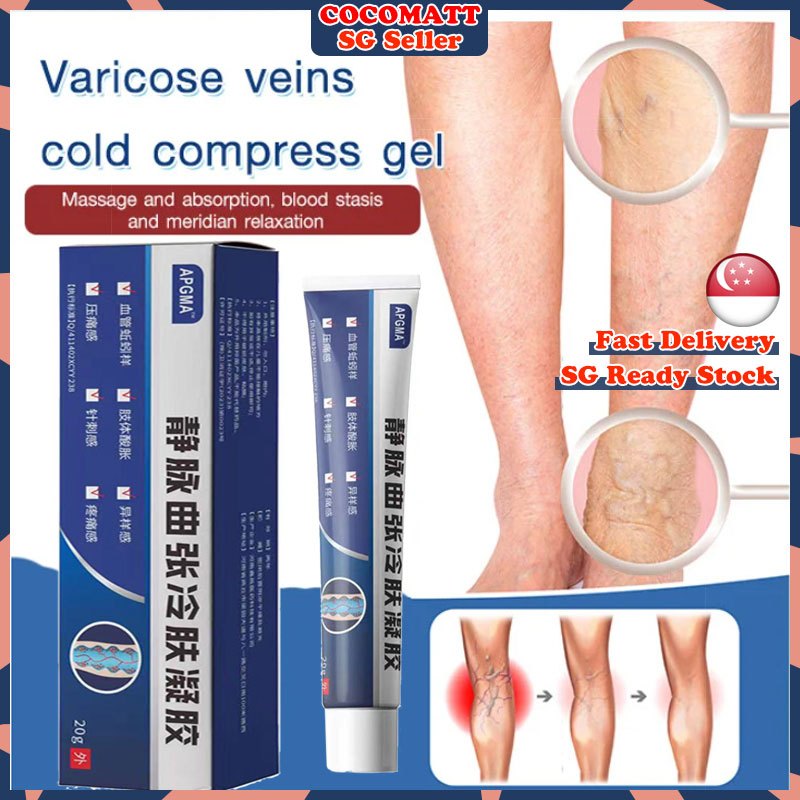 ️𝑺𝑮 𝑺𝑻𝑶𝑪𝑲 ️ Varicose vein cold compress gel / Effective varicose veins relief cream / Varicose