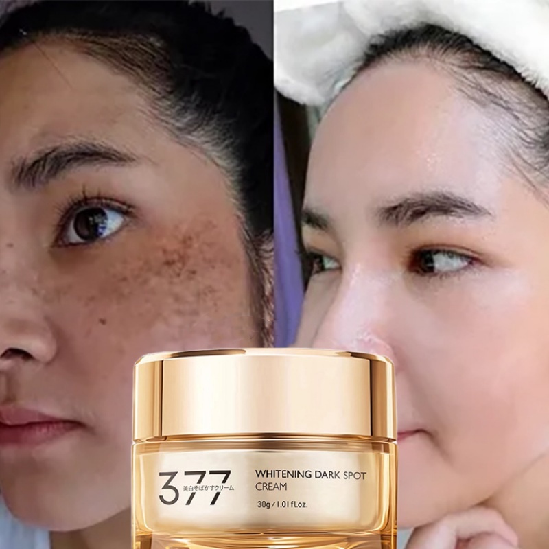 377 whitening cream 30g Whitening and Anti-freckle Cream moisturizing ...