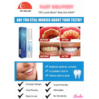 Lanthome Teeth Whitening Products | Shopee Singapore