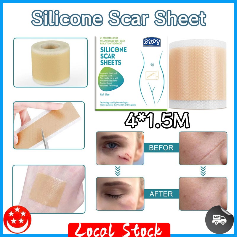 SG in Stock Silicone Scar Sheet 1Rol 4*1.5M Repair Sticker Skin Tape ...