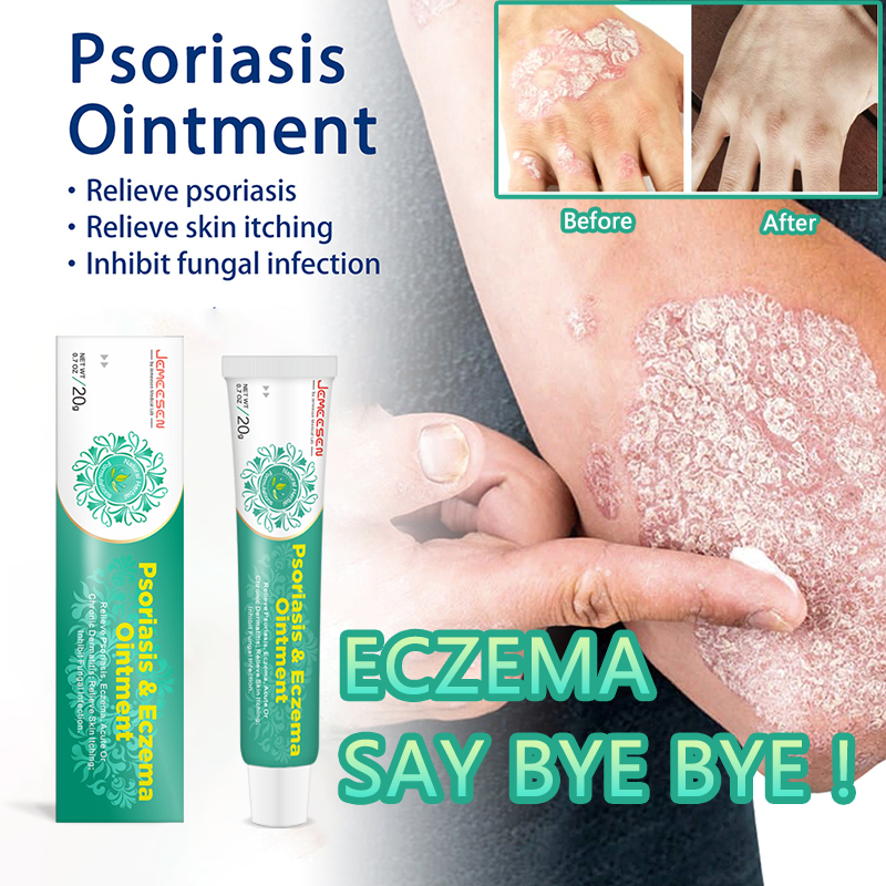 Product image Jemeesen Eczema Cream Psoriasis Ointment Chinese Herbal Antifungal Cream Anti Bacteria, Anti Viral, Relief Itchy/Redness 1