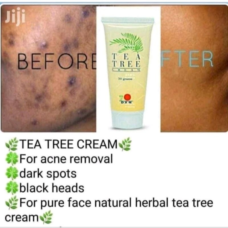 TEA TREE CREAM | Shopee Singapore