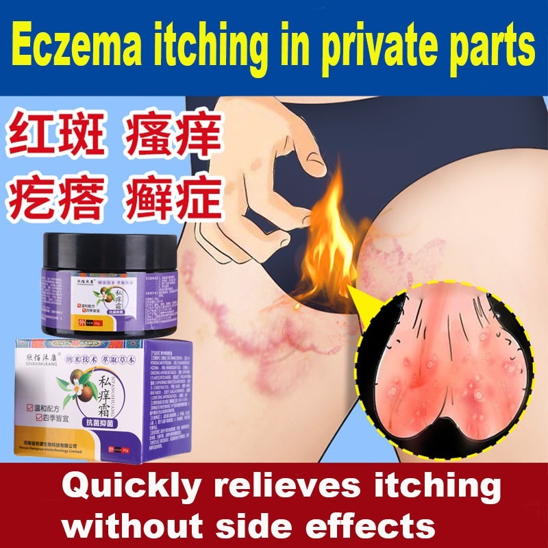 Eczema cream Antibacterial and itching Private parts antifungal cream ...