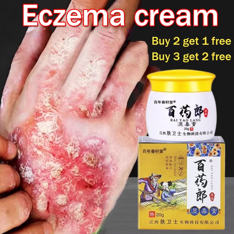 Eczema Cream Psoriasis Cream Itchy Skin Cream Anti Fungal Itch Relief ...