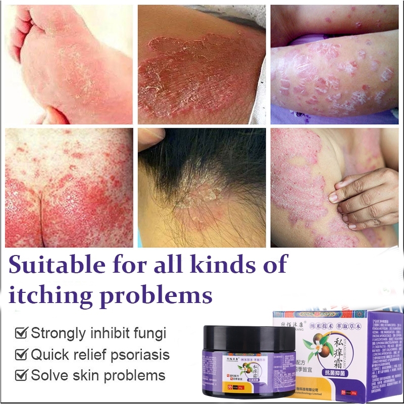 Eczema cream Antibacterial and itching Private parts antifungal cream ...