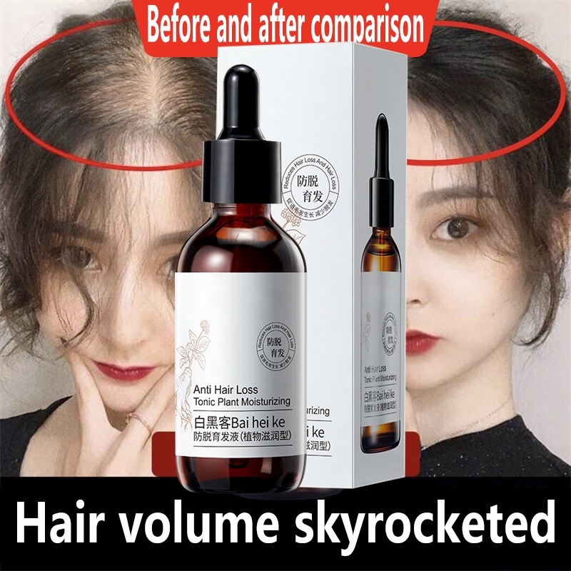 100% Effective hair serum hair grower for men original minoxidil hair ...