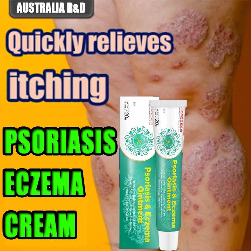 Jemeesen Psoriasis Ointment Eczema Cream For Itchy Skin Relief Gatal ...