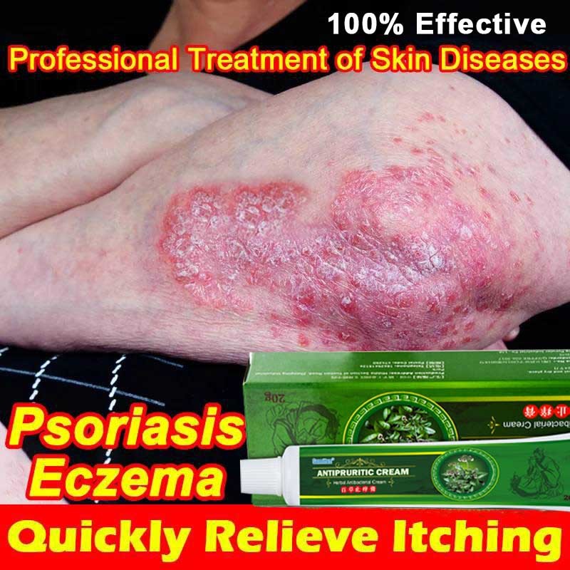 20g Anti-Itch Cream Antibacterial and antipruritic cream Remove ...
