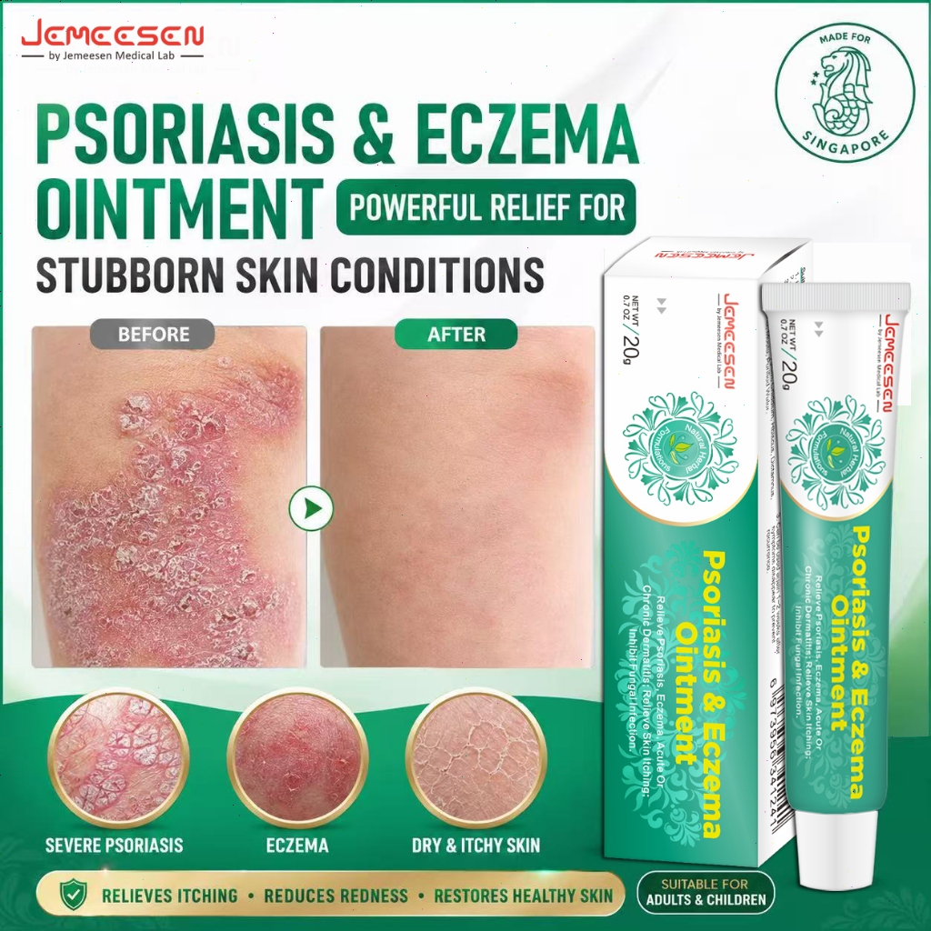 Jemeesen Psoriasis Eczema Cream Relieve Itchy Skin Herbal Soothing ...