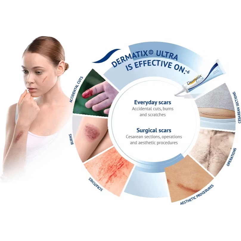 Product image 🔸𝟏𝟎𝟎%𝐎𝐫𝐢𝐠𝐢𝐧𝐚𝐥🔸𝑫𝒆𝒓𝒎𝒂𝒕𝒊𝒙 𝑼𝒊𝒕𝒓𝒂 Krim Hilangkan Scar 𝟭𝟱𝗴 Acne Scar Hyperplasia Scar DanCaesarean Section Scar Cream ReductionCream Advance Gel Scar Formula 6