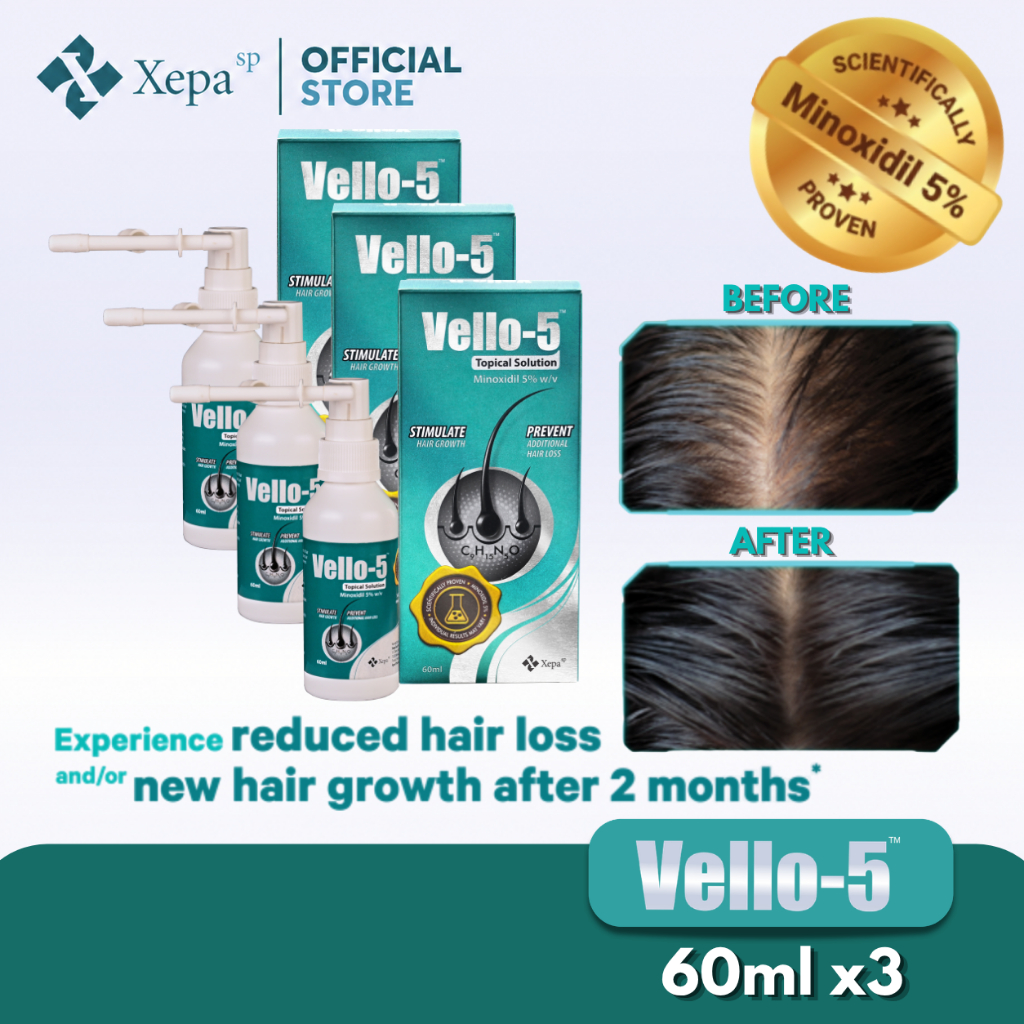 [Xepa SG Official Store][Hair Growth Starter]Vello-5 Minoxidil 5% ...