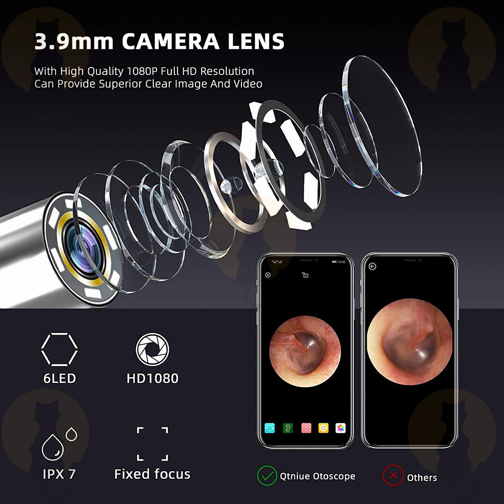 [ SG Ready Stock] Smart Visual Ear Picks Ear Cleaner Otoscope Ear Wax ...