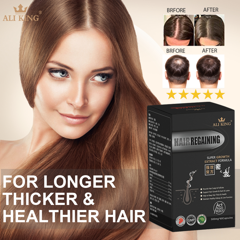 Hair Regaining Super Hair Growth - Extract Formula - Stop Hair Loss ...