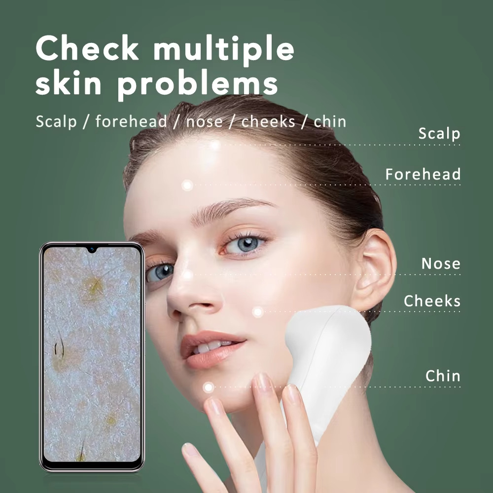 Hair Scalp Visual Dermoscope - Hi-Res Diagnostic Trichoscope - APP ...