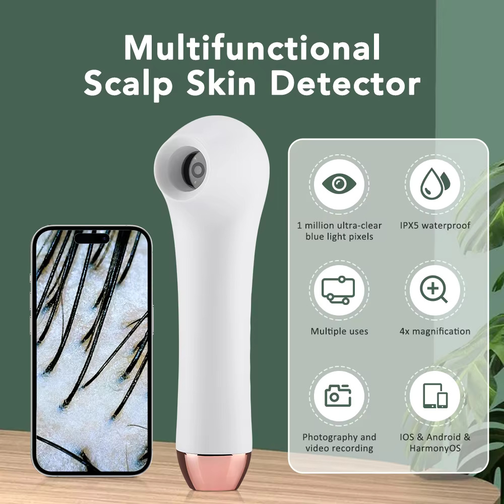 Hair Scalp Visual Dermoscope - Hi-Res Diagnostic Trichoscope - APP ...