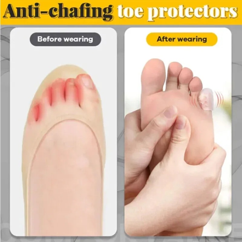 5pcs Silicone Toe Caps Anti-Friction Breathable Toe Protector Prevents ...