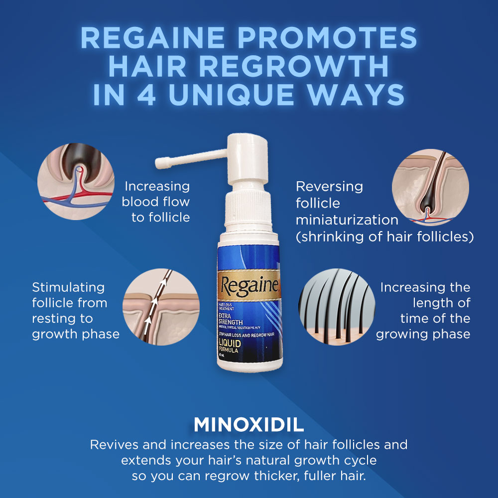 Regaine Extra Strength Minoxidil Topical Solution 5 W V Solution Stop