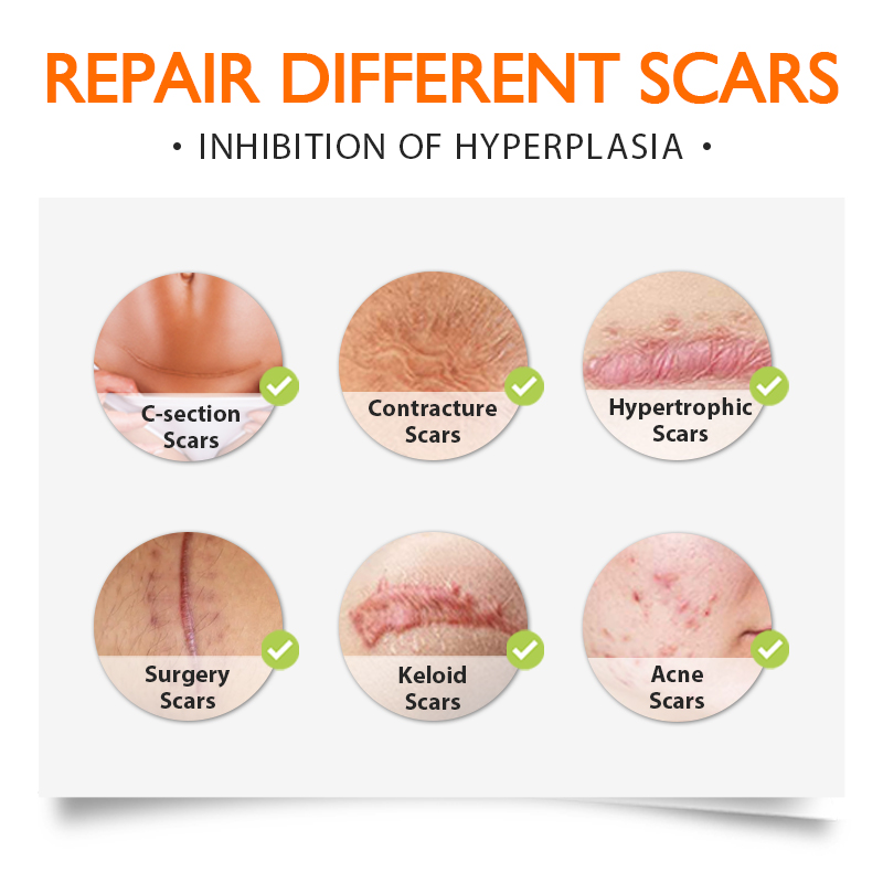 Flowweek Scar Patch Silicone Plaster Scar Removal Reuseable for C ...