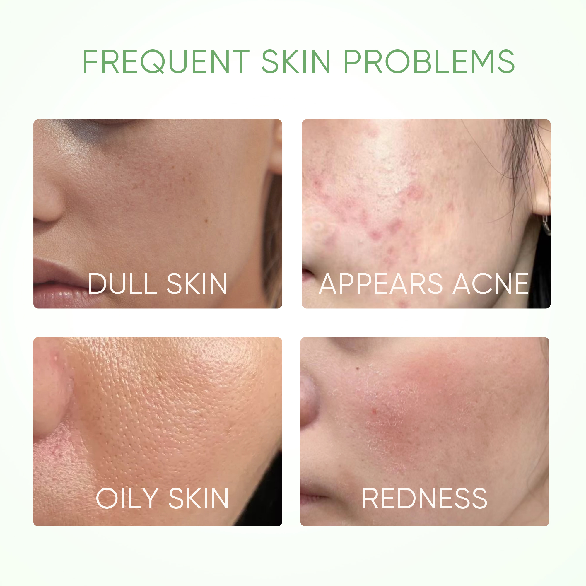 SKINTIFIC Mugwort/Niacinamide/Volcano Acne Clay Stick Mask - Cleanses ...