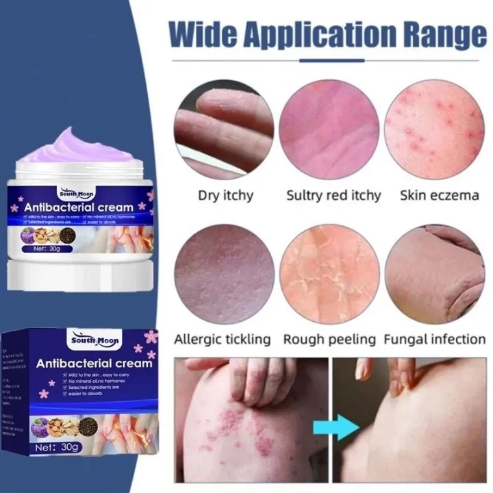 🎈SG stock🎈 Antibacterial cream / Psoriasis ointment eczema cream Itch ...