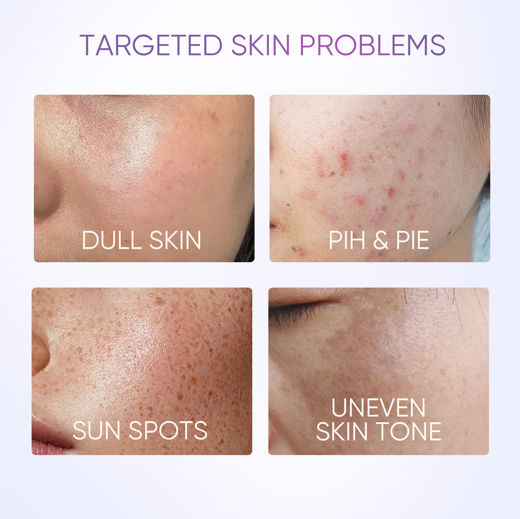 【10.10 EXCLUSIVE】SKINTIFIC Symwhite 377 Dark Spot Moisturiser 30g-for ...