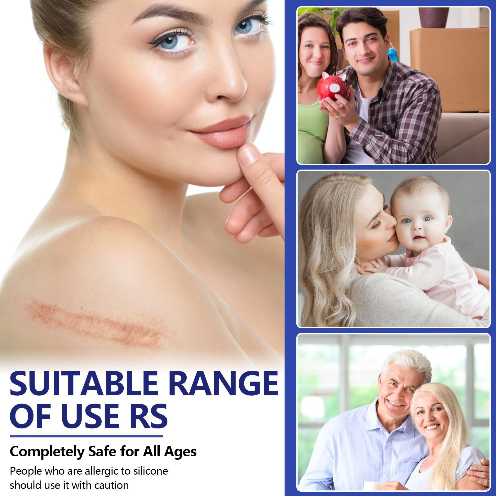 [SG Stock]SCAR Treatment Scar Removal Scar Patch Scar Sticker ELAIMEI ...