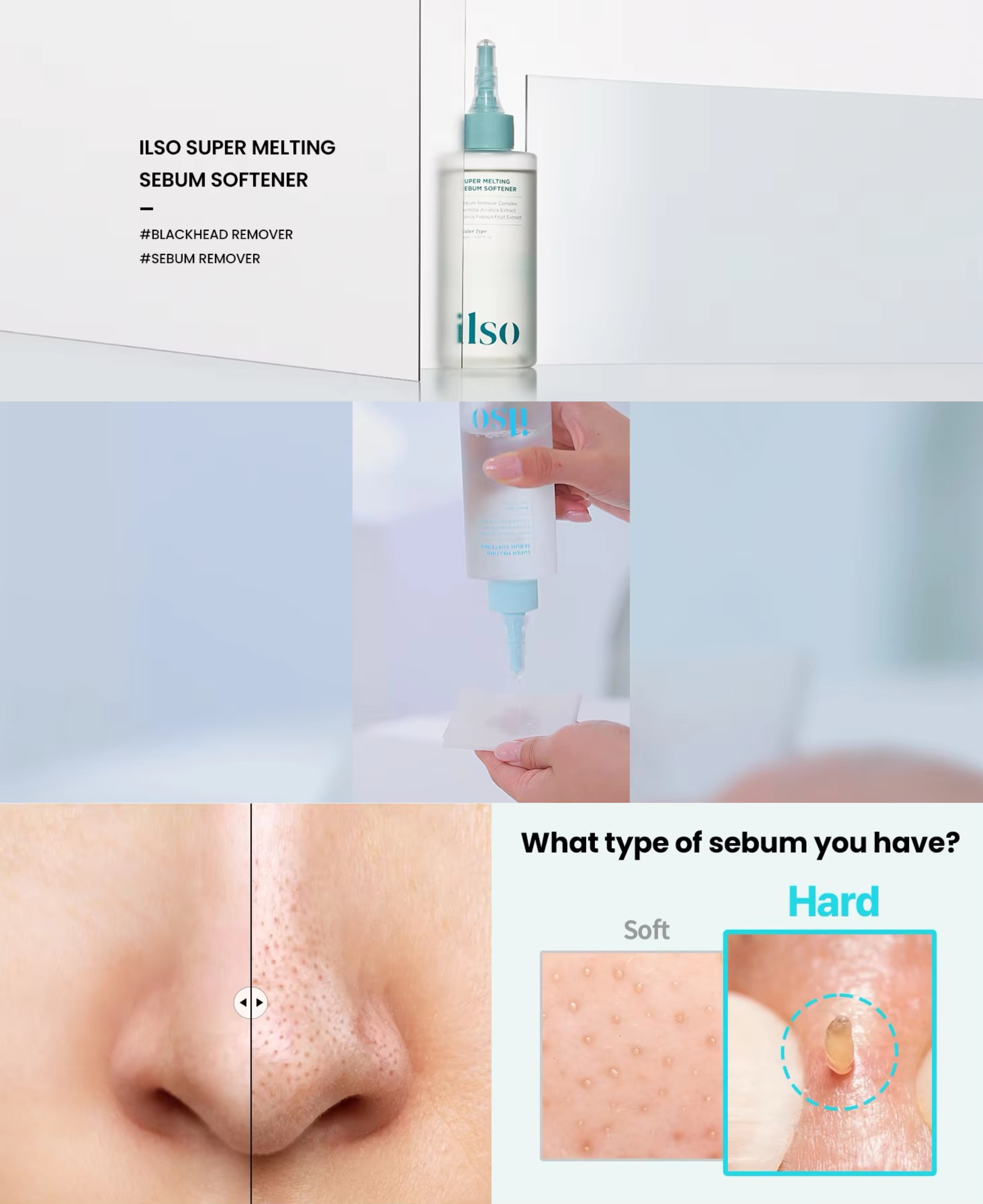 【SG】Blackhead Extraction Solution - Controls Oil, Removes Acne and ...