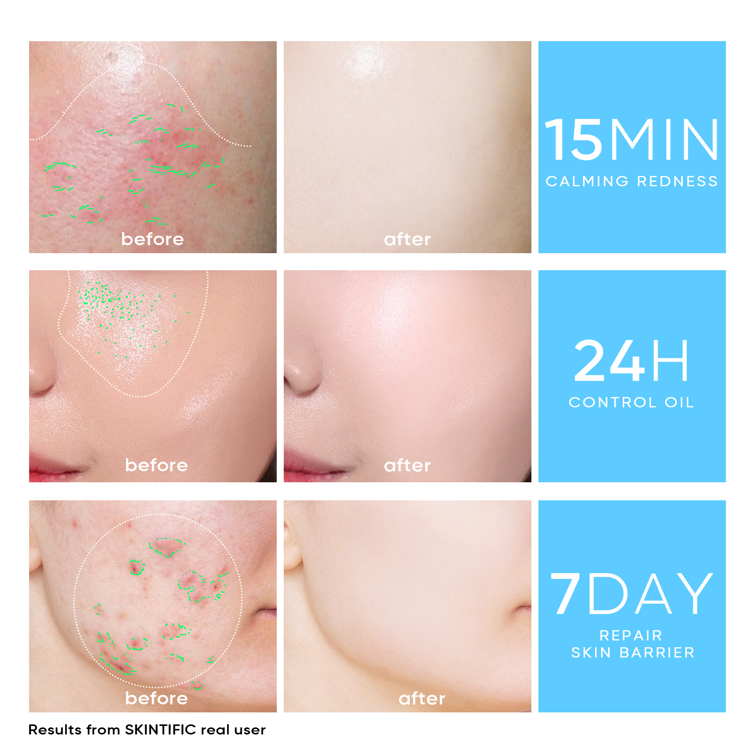 [NEW LAUNCH] SKINTIFIC 5X Ceramide Moisture Gel - Light Texture Oil ...