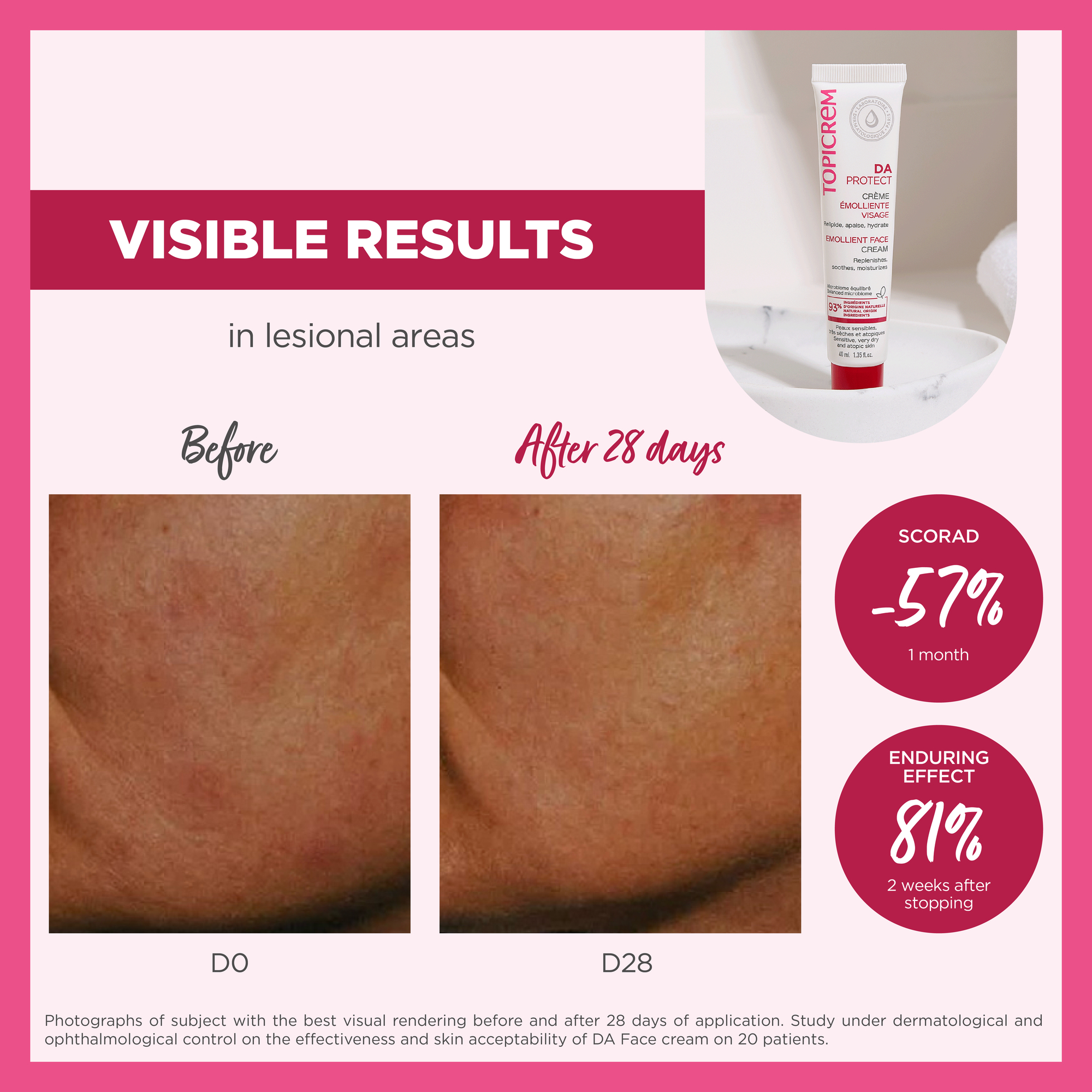 Topicrem DA PROTECT Emollient Face Cream 40ml Atopic Skin ...